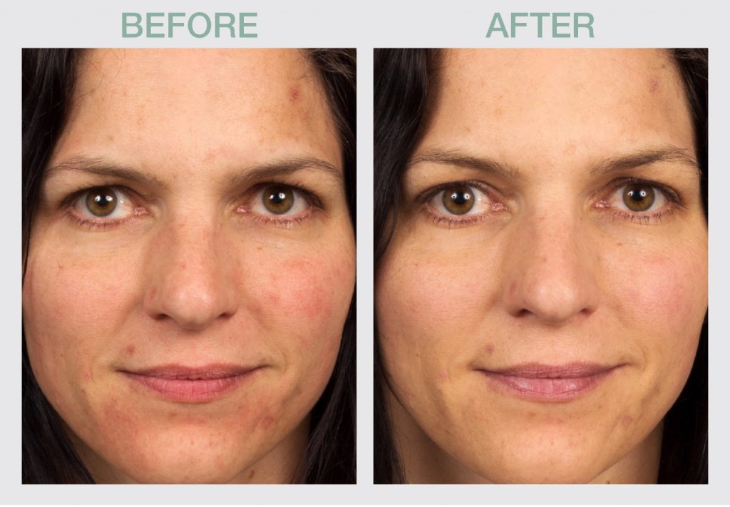 Universal-Perfection-Tinted-SPF-50-Sunscreen-1